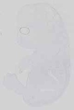 EMAGE:14285