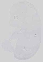 EMAGE:14285