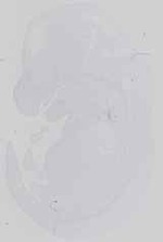 EMAGE:14285