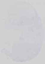 EMAGE:14285