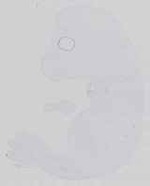 EMAGE:14285