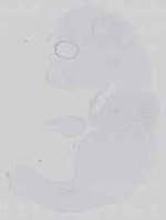 EMAGE:14285