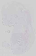 EMAGE:14291