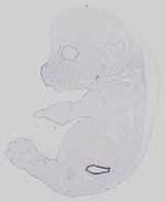 EMAGE:14296