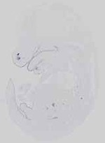 EMAGE:14296