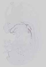 EMAGE:14296