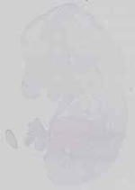 EMAGE:14307