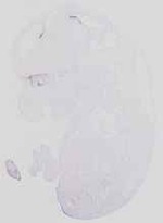 EMAGE:14308