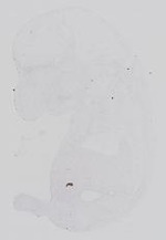 EMAGE:14311