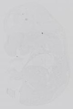 EMAGE:14311