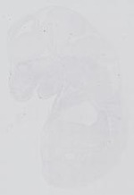 EMAGE:14314