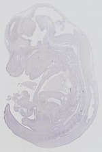EMAGE:14314
