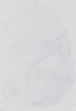 EMAGE:14330