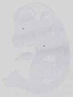 EMAGE:14331