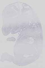 EMAGE:14331