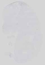 EMAGE:14331