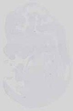 EMAGE:14331