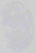 EMAGE:14378