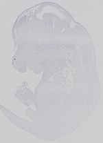 EMAGE:14380