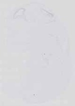 EMAGE:14387