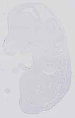 EMAGE:14387