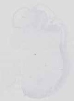 EMAGE:14389