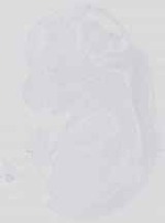EMAGE:14390