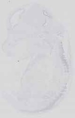 EMAGE:14391
