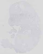 EMAGE:14392