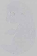 EMAGE:14394