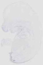 EMAGE:14395