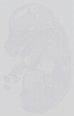 EMAGE:14403