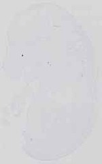 EMAGE:14404