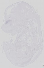 EMAGE:14405