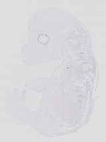 EMAGE:14407