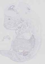 EMAGE:14408
