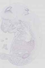 EMAGE:14408