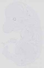 EMAGE:14408