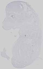 EMAGE:14415