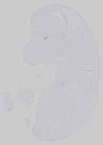 EMAGE:14419