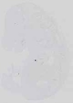 EMAGE:14447