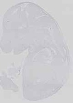 EMAGE:14447