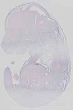 EMAGE:14447