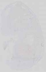 EMAGE:14447