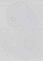 EMAGE:14447