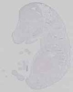 EMAGE:14451