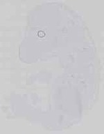 EMAGE:14451