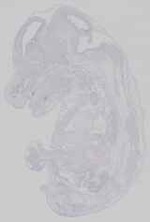 EMAGE:14458