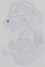 EMAGE:14465
