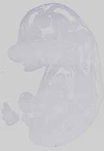 EMAGE:14467
